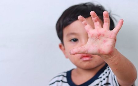 চট্টগ্রামে শিশুদের ’হ্যান্ড ফুট অ্যান্ড মাউথ’ জনিত রোগ বৃদ্ধি পাচ্ছে