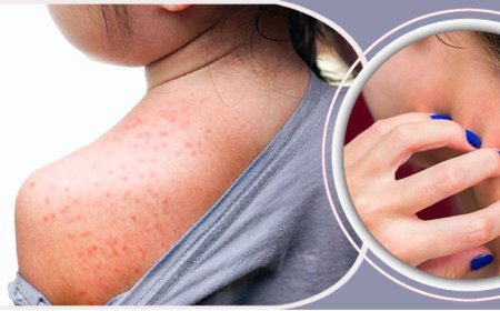 ঘামাচির সমস্যা ,সমাধান ও প্রতিরোধের উপায়